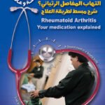 كيف تتعايش مع التهاب المفاصل الرثياني؟ شرح مبسط لطريقة العلاج