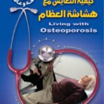 كيفية التعايش مع هشاشة العظام